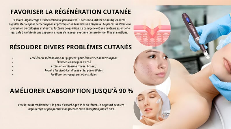 Dr Pen Ultima A10, Derma système de Microneedling pour le visage – Image 4