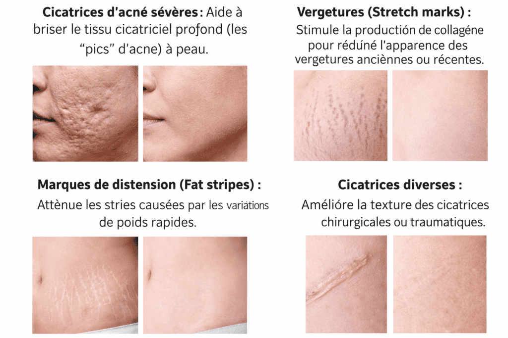 Indications et Bienfaits Cartouche Dr Pen M5 9PIN